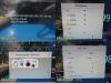 PHILIPS MP30 Intellivue, W/ MMS 3001A Module & Leads~  Multi-Para Monitor