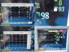 PHILIPS MP30 Intellivue, W/ MMS 3001A Module & Leads~  Multi-Para Monitor