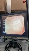 OLYMPUS GIF-H260Z Gastroscope