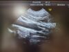 GE IC5-9-D Ultrasound Transducer