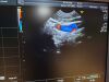 GE IC5-9-D Ultrasound Transducer