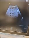 GE RAB2-6-RS Ultrasound Transducer