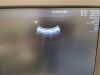 GE RAB2-6-RS Ultrasound Transducer