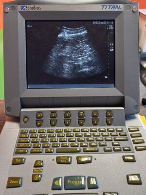 SONOSITE TITAN Ultrasound - OB / GYN