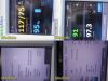 WELCH ALLYN W.A Hill Rom Connex VSM 6000 Series Ref 64NTXX Monitor