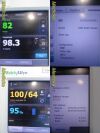 WELCH ALLYN W.A Connex VSM 6000 Series Vitals Touchscreen Monitor