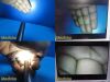 OLYMPUS A5240 Olympus A5240 OES Rigid Telescope10mmx8°