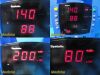 GE Dinamap PROCARE 400 Vitals Monitor