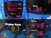 DINAMAP Procare 400 Series Nellcor SpO2 Monitor