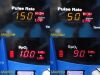 DINAMAP Procare 400 Series Nellcor SpO2 Monitor