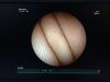 FUJINON EG-530N Endoscope