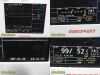 Bayer Medrad Veris 8600 MR Monitor