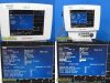 Bayer Medrad Veris 8600 MR Monitor