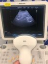 PHILIPS HD9 Ultrasound System with C6-3 Abdominal, V9-4v Vaginal Transducer