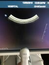 PHILIPS C8-5 Ultrasound Transducer