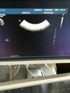 PHILIPS C8-5 Ultrasound Transducer