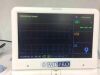 EDAN MD Pro Fetal Monitor