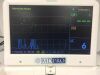 EDAN MD Pro Fetal Monitor