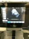 CHISON Sonotouch 30 Touch Screen Portable Ultrasound Machine  Three Probes