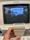 PHILIPS HDI 5000 Ultrasound Machine w/  Three Probes, Patient Ready
