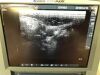 SONOSITE SLT10/5 Ultrasound Transducer