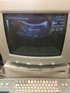 ACUSON 5C2G Abdominal Ultrasound Transducer