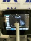 CHISON Sonotouch 30 Portable Ultrasound Machine