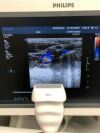 PHILIPS L8-4 Ultrasound Transducer
