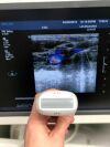 PHILIPS L8-4 Ultrasound Transducer