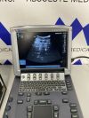 SONOSITE M-Turbo Ultrasound - OB / GYN