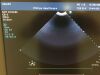 PHILIPS C8-5 Ultrasound Transducer