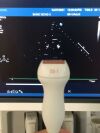 PHILIPS IE33 Ultrasound System