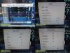 PHILIPS 2011  Intellivue MP3,0W/ MMS Module M3001A & Leads ~ Patient Monitor