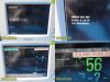 PHILIPS Intellivue MP20,Ref M8001A MMS Module M3001A, New Leads ~ Monitor