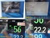 PHILIPS 2011  M8002A Intellivue MP30, New Leads, M3001A MMS Module ~ Monitor