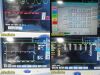 SPACELABS 91369 Ultraview SL, W/ 91496 Module & Patient Leads ~ Monitor