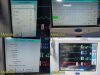 SPACELABS 91369 Ultraview SL, W/ 91496 Module & Patient Leads ~ Monitor