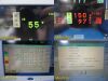 SPACELABS 91370 Ultraview SL ,W/ Patient Leads & 91496 Module ~ Monitor