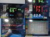 SPACELABS 91370 Ultraview SL,W/ Patient Leads & 91496 Module ~ Monitor