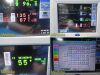 SPACELABS Ultraview SL 91367,W/ 91496 & Patient Leads ~  Patient Monitor