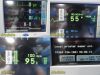 SPACELABS Ultraview SL 91369 ,W/ 91496/91493 Modules,Leads ~Patient Monitor