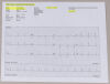 WELCH ALLYN CARDIO PERFECT SE-PRO-600 MODULE WITH LEADS AND USB DATA CABLE EKG