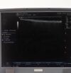 GE 16L-RS Ultrasound Transducer