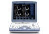 GE Vivid I Ultrasound Machine