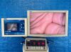 KARL STORZ H3-Z HD 22220055 Tested (Camera Head only) Laparoscope