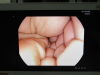 PENTAX EG-2990i Gastroscope
