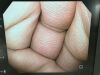 OLYMPUS GIF-H290Z Gastroscope