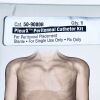 CAREFUSION REF 50-9000B PleurX Peritoneal Catheter System