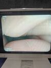 PENTAX EG-2970K Gastroscope