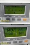 PHILIPS Series 50XM M1350B Maternal ,W/Transducers,Leads,Cart~ Fetal Monitor